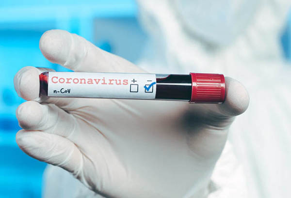 В рязанском регионе от коронавируса выздоровели 89 человек