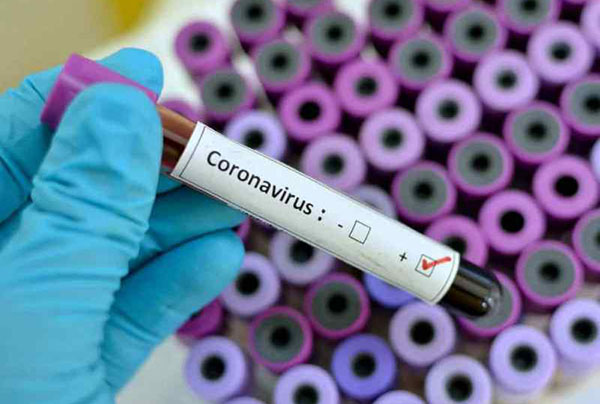 Первый случай коронавируса в Рязани
