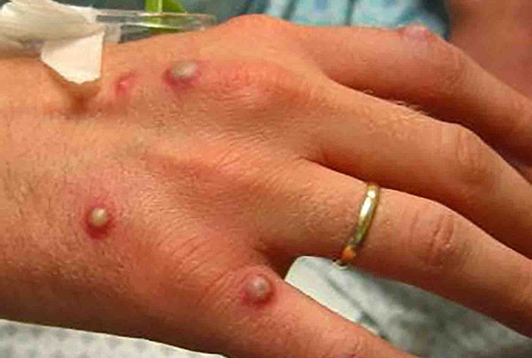 ��� ��� ������ ���� ������� �������� � �����������