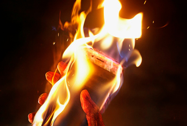 Из ОКБ Рязани выписали пациентку с ожогами от возгорания телефона