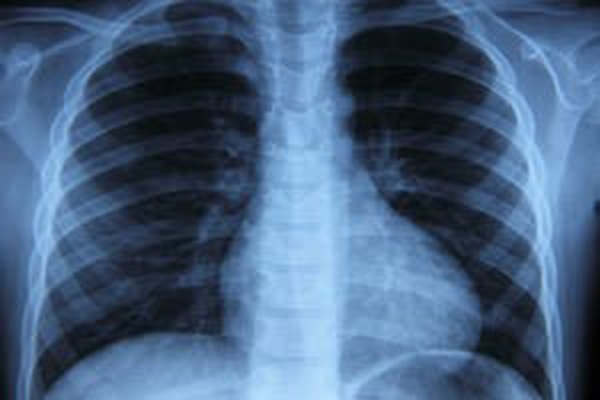 Рентген или просвечивания органов грудной полости 